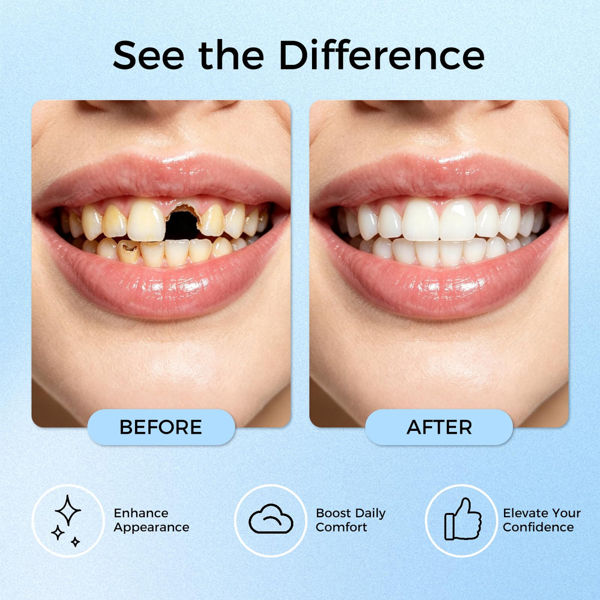 Upper & Lower Dentures, Moldable Kit
