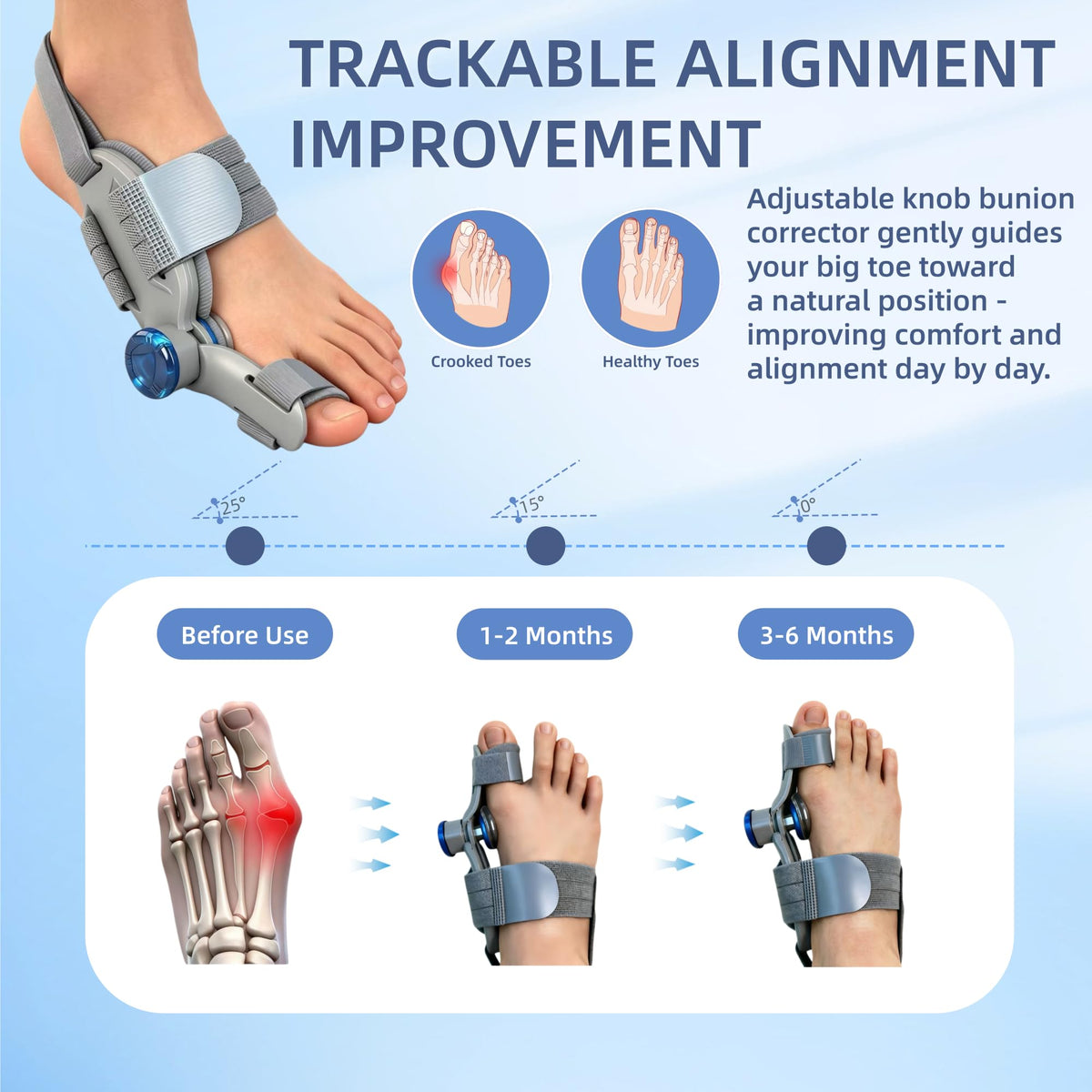 YLGNKIA Bunion Corrector for Women & Men, Adjustable Big Toe Straightener